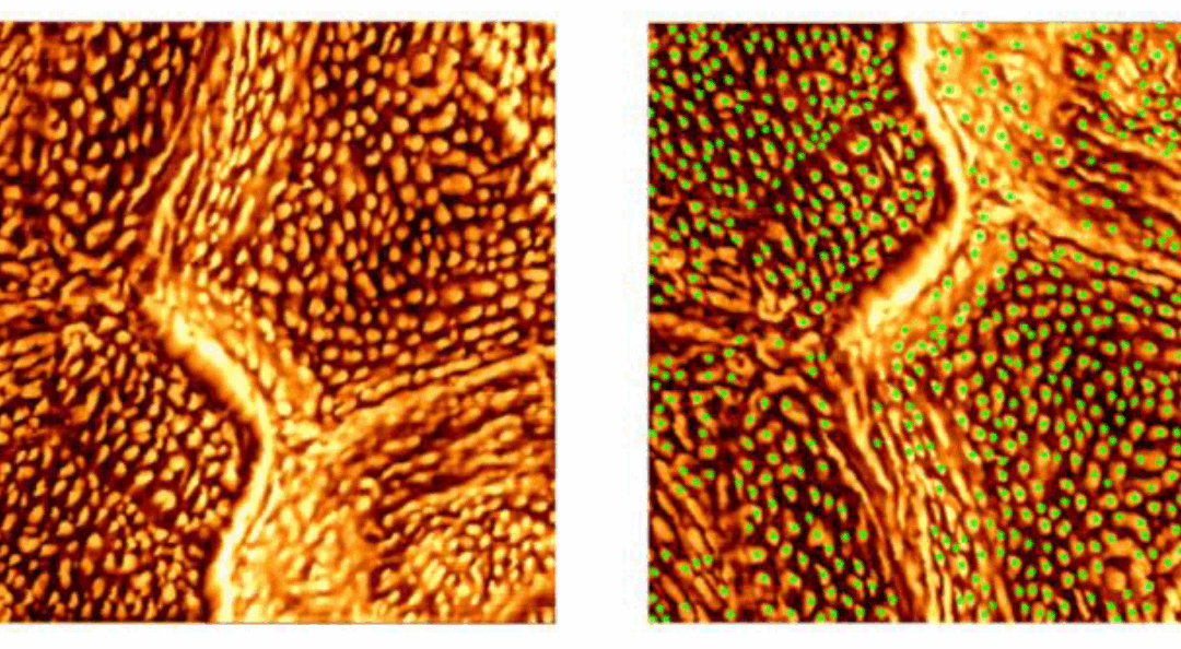 Stratum corneum nanotexture feature detection using deep-learning and spatial analysis: a non-invasive tool for skin barrier assessment