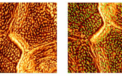 Détection des caractéristiques de la nanotexture du stratum corneum par deep learning et analyse spatiale : un outil non invasif pour l’évaluation de la barrière cutanée